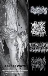 Impulso Corrosivo : Postpartum Impulse of a Corpse Infected with Parasites